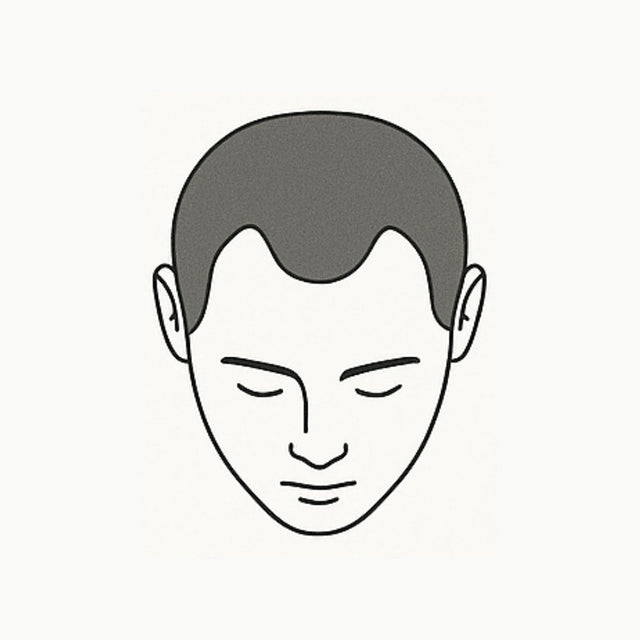 Noticeable Thinning
