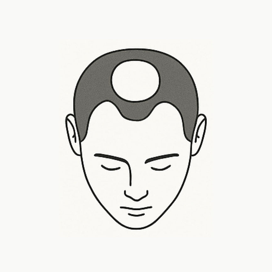 Noticeable Hair Loss?